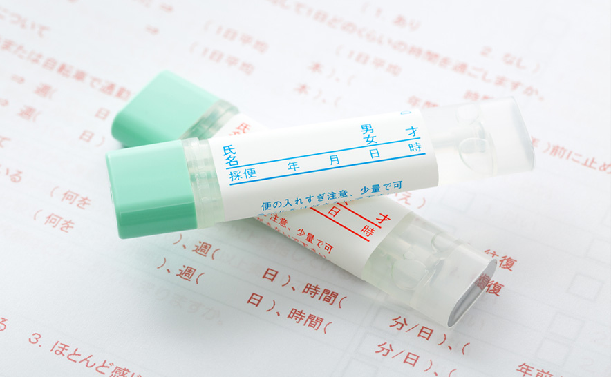 便潜血検査で、陽性(＋)と診断された方は二次検査で大腸カメラ検査を受けましょう