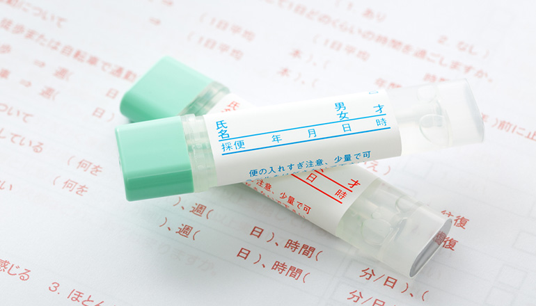 便潜血検査で、陽性(＋)と診断された方は二次検査で大腸カメラ検査を受けましょう